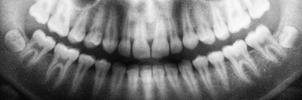 My Top Natural Oral Health Care Tips