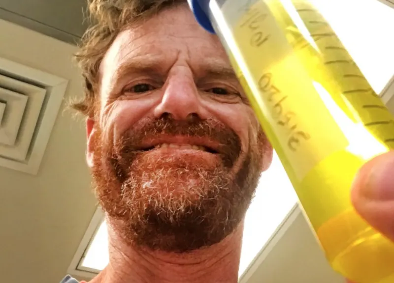 Antídoto contra el veneno de serpientes serviría para tratar el COVID-19