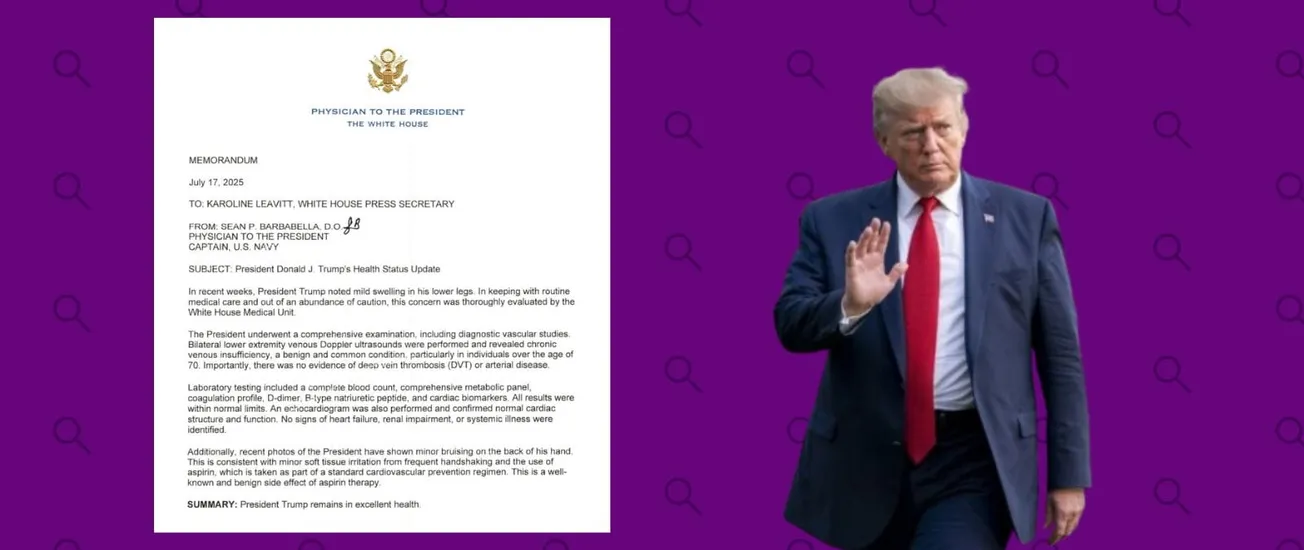 Insuficiencia venosa crónica: qué sabemos sobre la enfermedad que padece Donald Trump