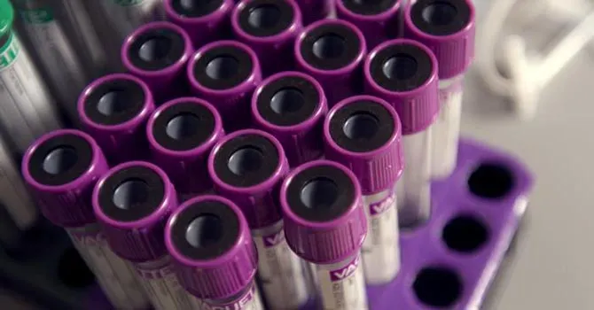 Médicos hallan la causa del brote de hepatitis pediátrica