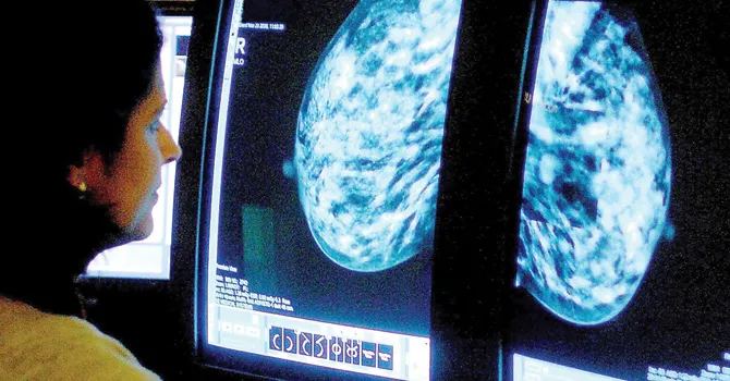 Las innovaciones más prometedoras en el diagnóstico y el tratamiento del cáncer