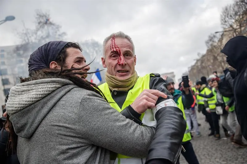 Integrante de "chalecos amarillos" pierde una mano durante protesta en París