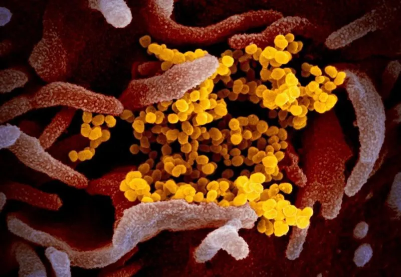 Empleados de un hospital de California están siendo monitoreados tras atender a paciente con coronavirus