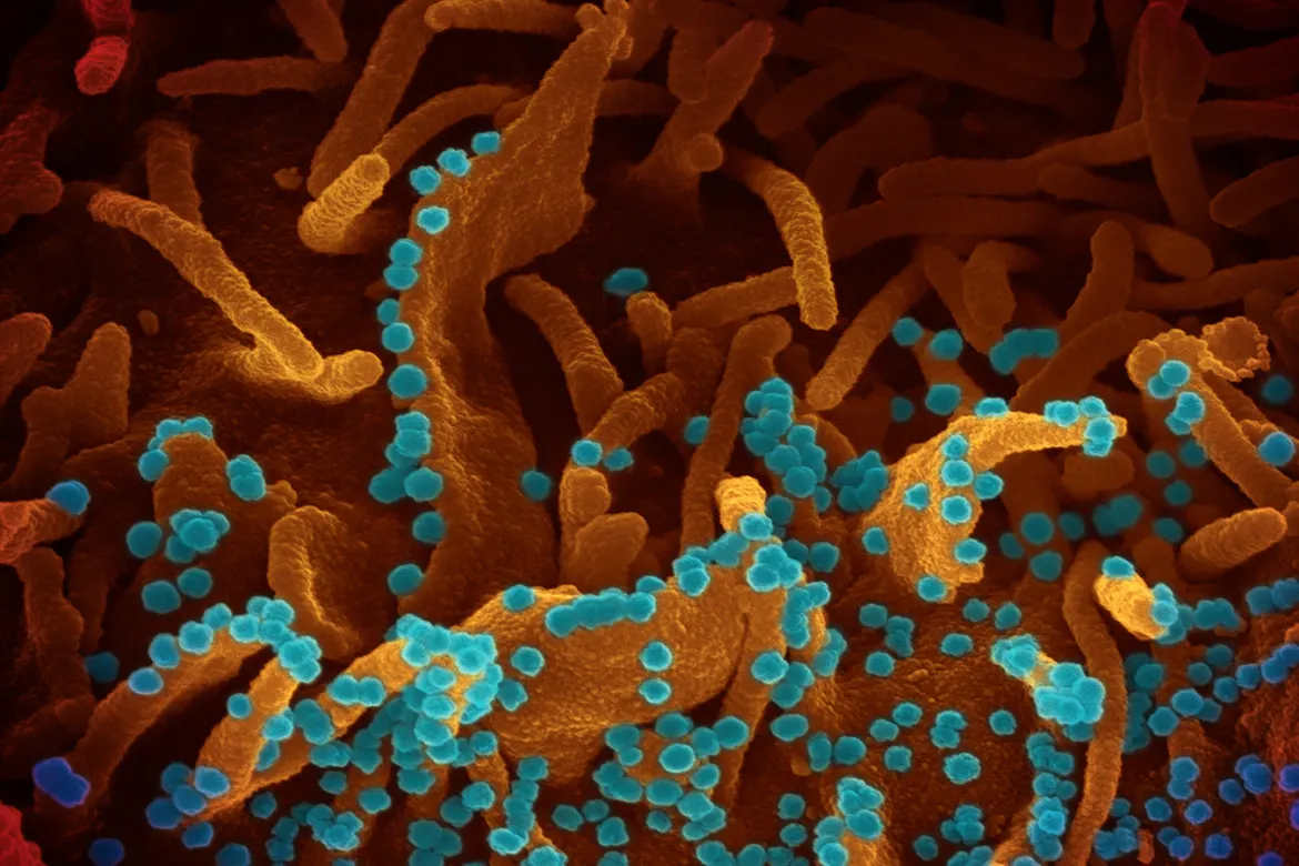 Científicos descubren medicamento para evitar que el coronavirus crezca en los pulmones