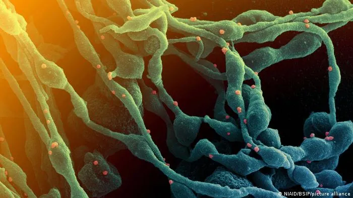 COVID-19 se relaciona con riesgo 33 veces mayor de coágulo sanguíneo grave hasta seis meses después del contagio