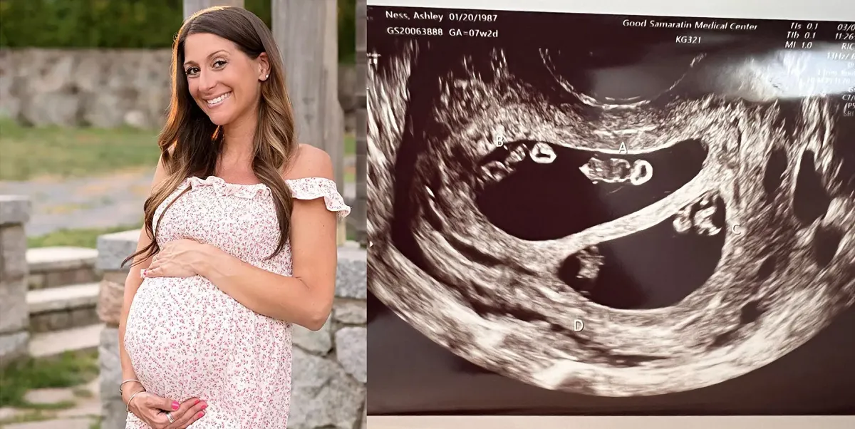Mujer de Massachusetts tuvo cuatro pérdidas y ahora tendrá cuatrillizos