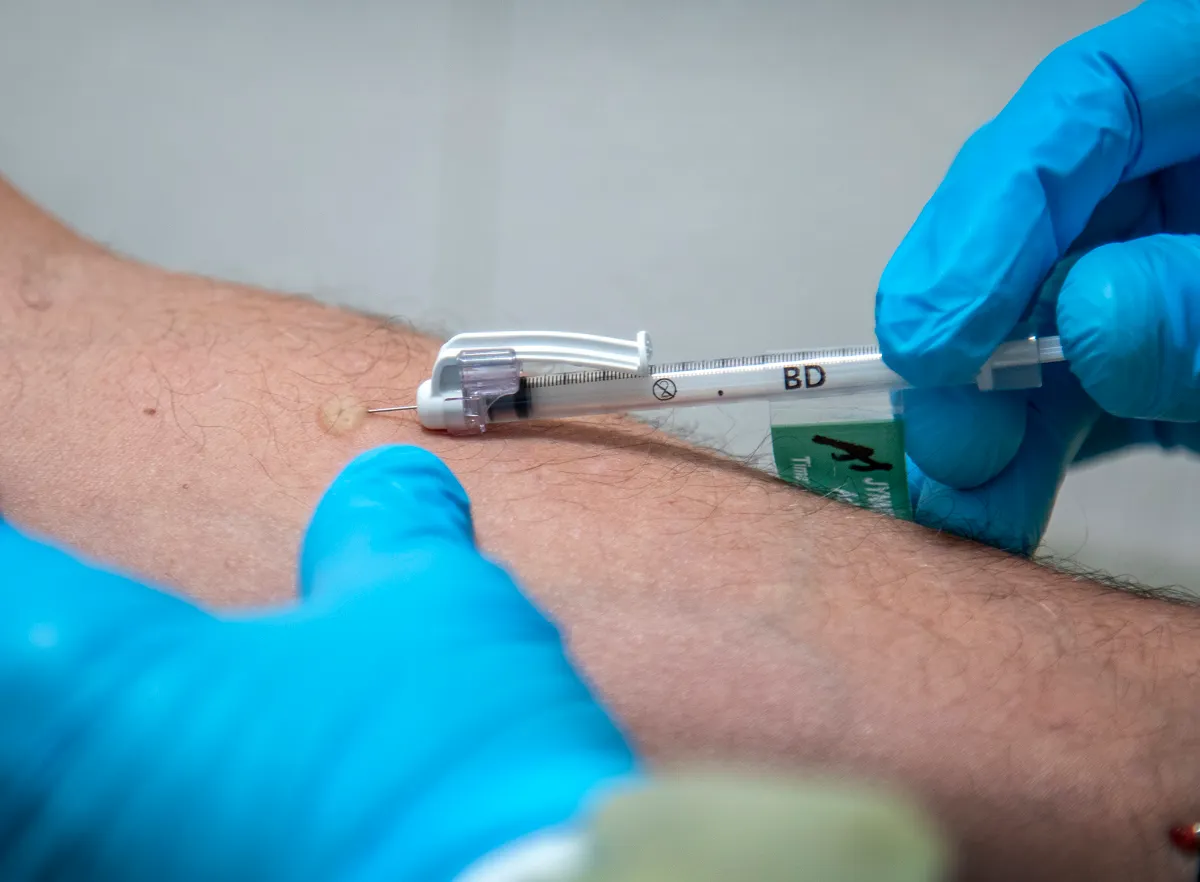 ¿Los humanos pueden transmitirle la viruela del mono a los perros?