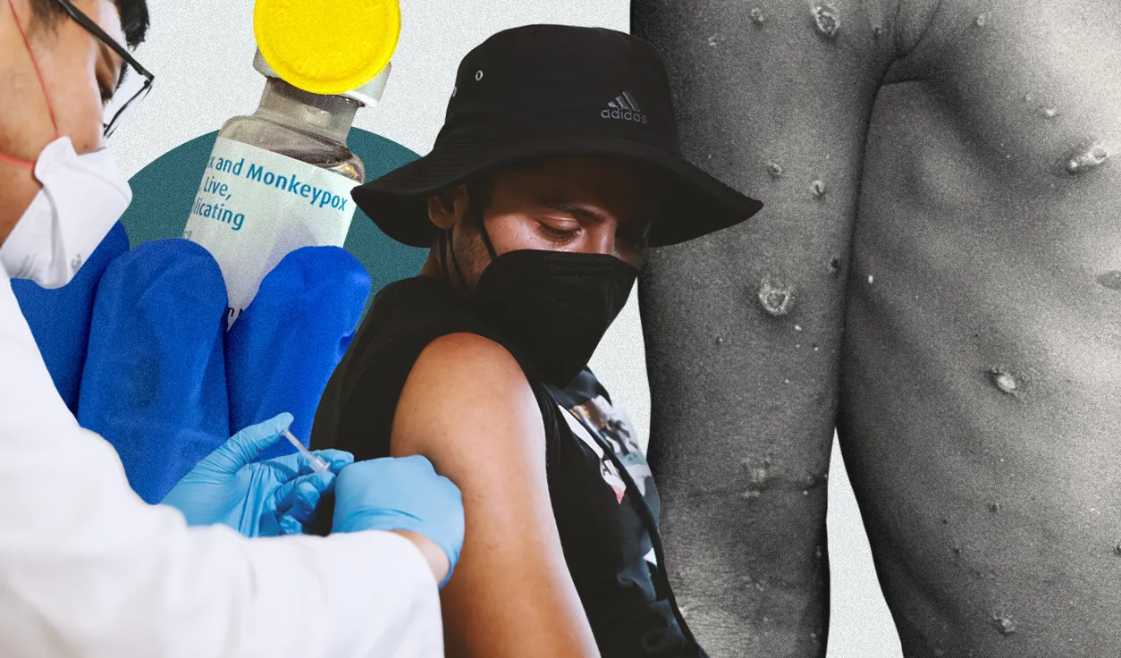 Viruela del mono, polio y superbacterias, ¿son una amenaza como el COVID?