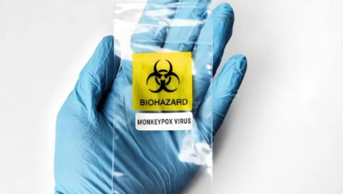 La viruela del mono no se contagia únicamente por contacto sexual