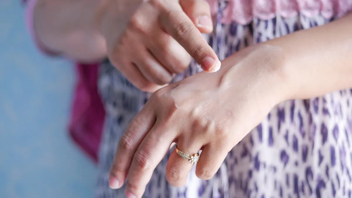 Ocho cosas que debes hacer en caso de una quemadura