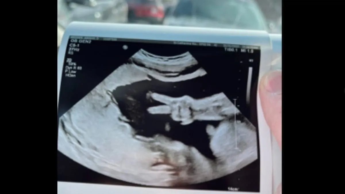 Bebé muestra el símbolo de amor y paz en ecografía