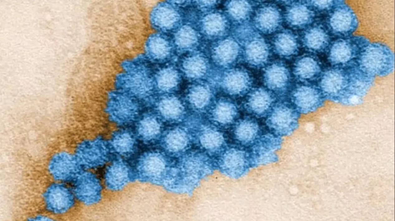 norovirus