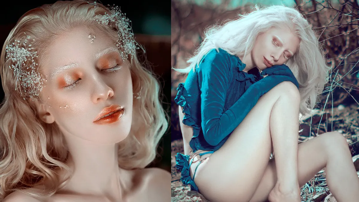 Ruby Vizcarra: latina que sorprende en el modelaje por ser albina