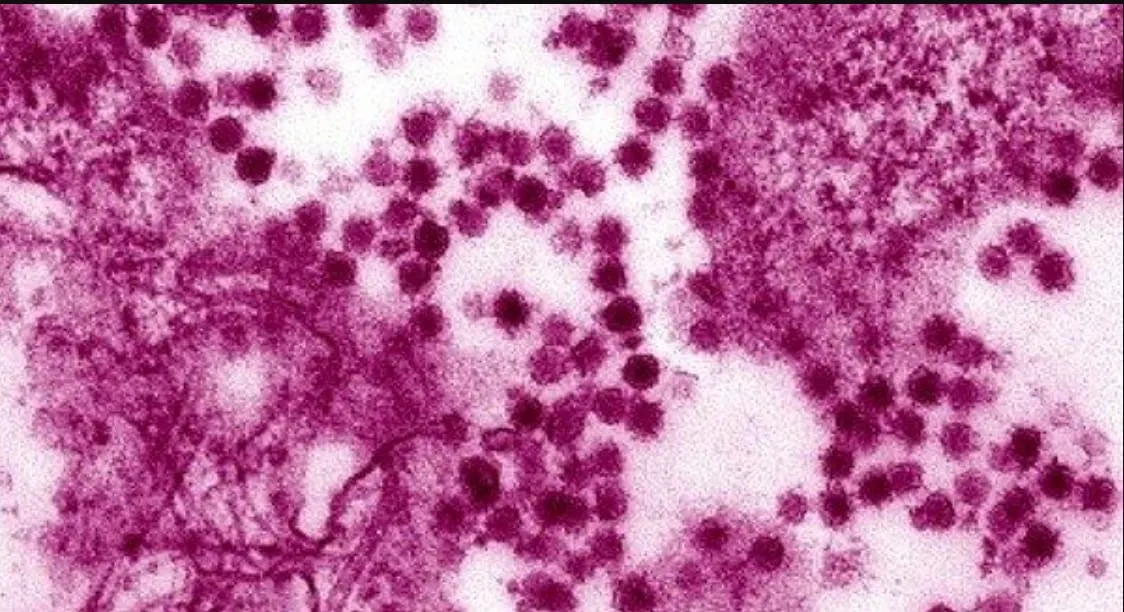 Prevención del virus del Nilo Occidental en Chicago