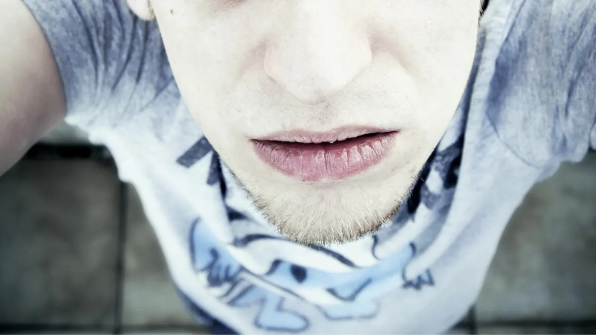 ¿Qué son los "labios de anemia" que hicieron viral a una tiktoker?