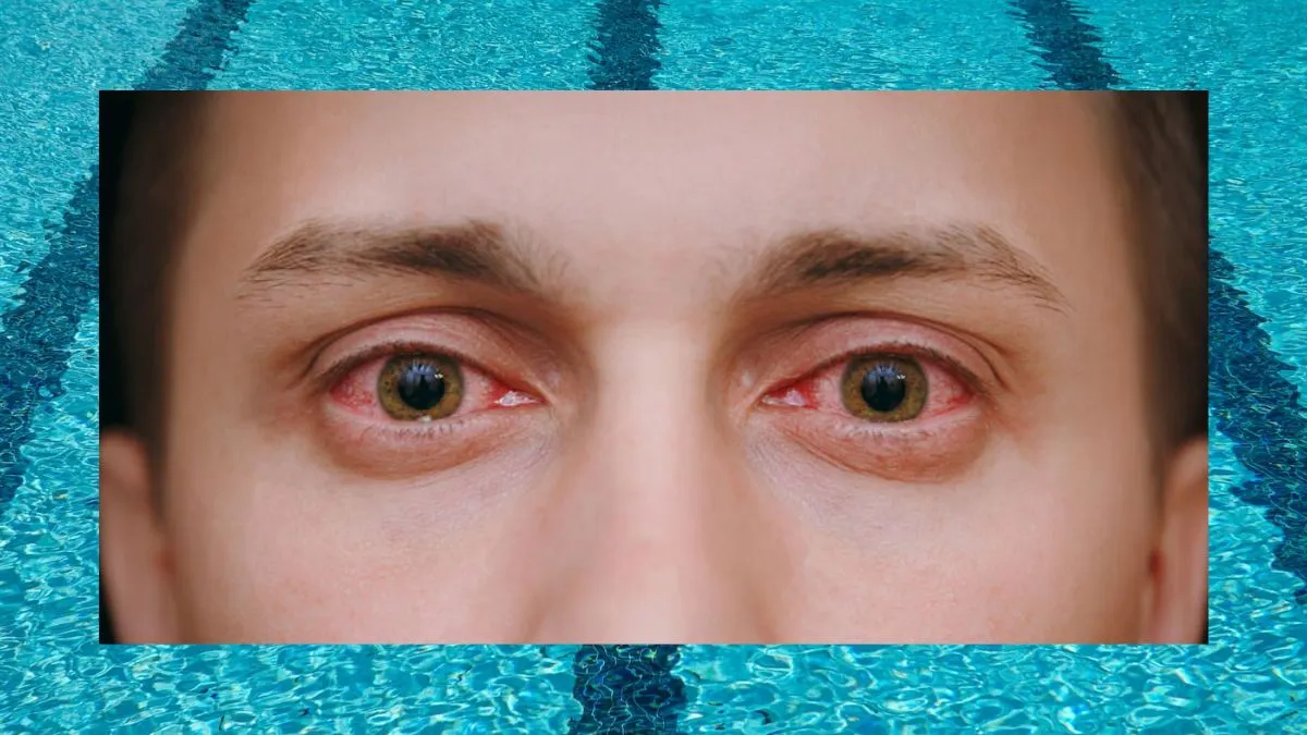 Por qué los ojos se ponen rojos en la piscina: no es sólo culpa del cloro