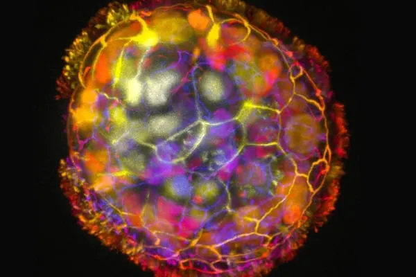 Antrobots ayudan en la reparacion neuronal