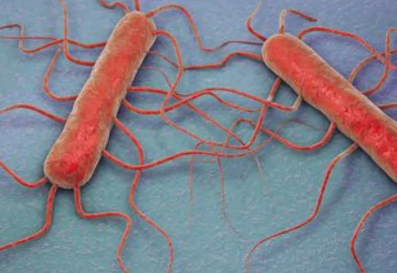 CDC investiga cuáles embutidos causan brotes de listeria en Illinois y Nueva Jersey