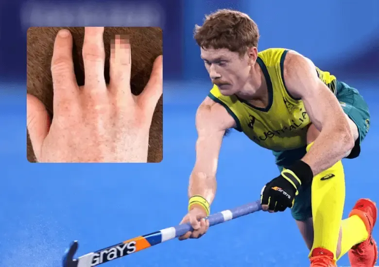 Dawson Juegos Olímpicos