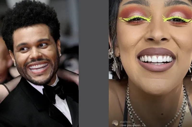 Carillas dentales: ¿Moda o necesidad? Descubre los riesgos