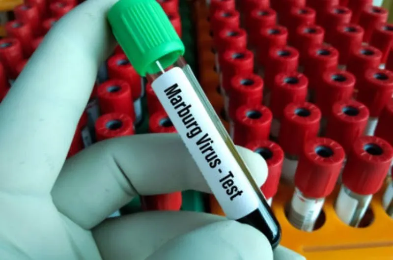 ¿Qué es el virus de Marburgo y por qué se implementan controles en EEUU?