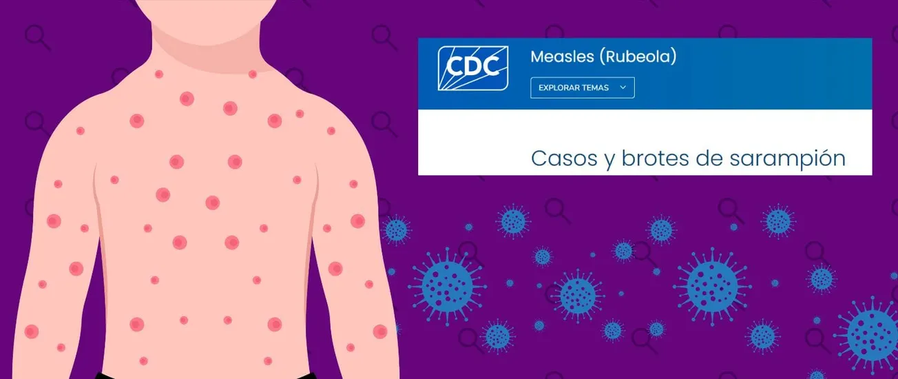 brote de sarampión