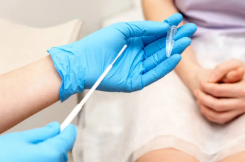 Tratamiento oral gepotidacin facilita el manejo de la gonorrea resistente a los medicamentos