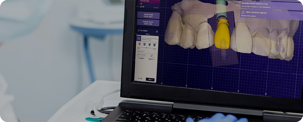 Dental technician reviewing a restoration through a professional Dental CAD Design Service