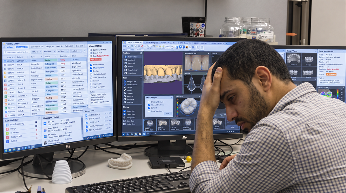 Dental technician managing multiple crown cases in a dental CAD design workflow