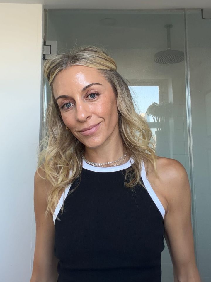 why I haven't done botox at 38 + what I do instead