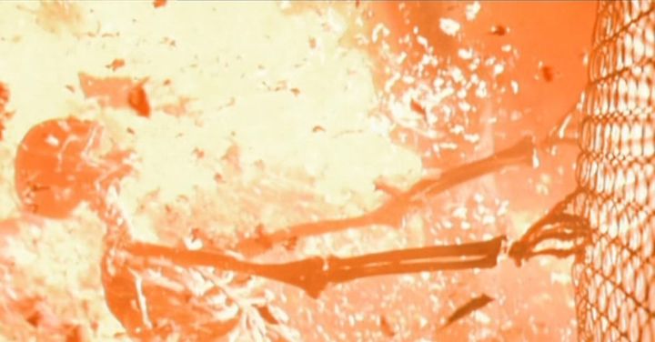So you nuked your pancreas