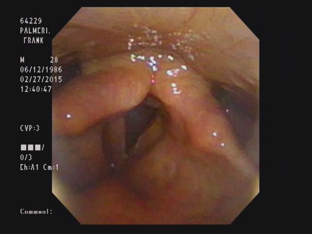 Frank Palmeri - Vocal Chords Tear Picture
