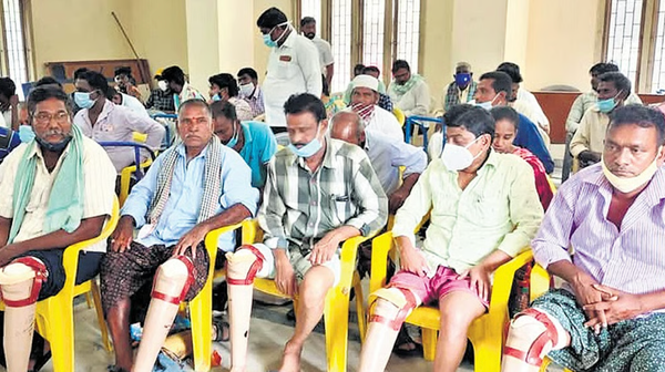 Free Artificial Limbs Distributed to 90 People in Andhra Pradesh, Supporting Mobility and Dignity