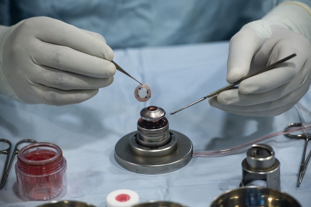 The Role Of Seed Funding For Alleviating Blindness In Poor Communities