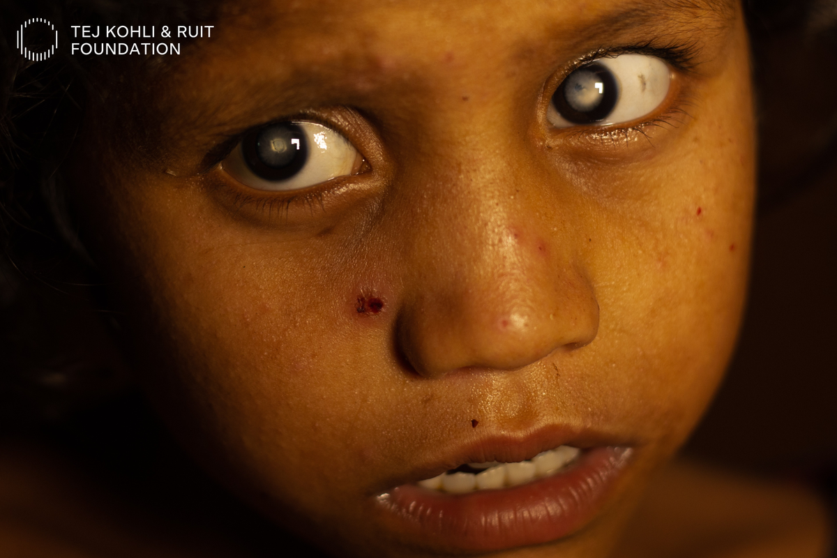 Childhood Blindness And Extreme Poverty | A Documentary Short By The Tej Kohli & Ruit Foundation