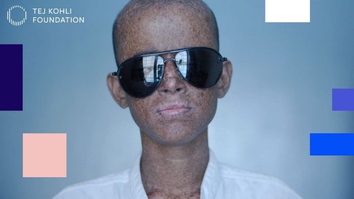 Tej Kohli: India’s Forgotten XP Children