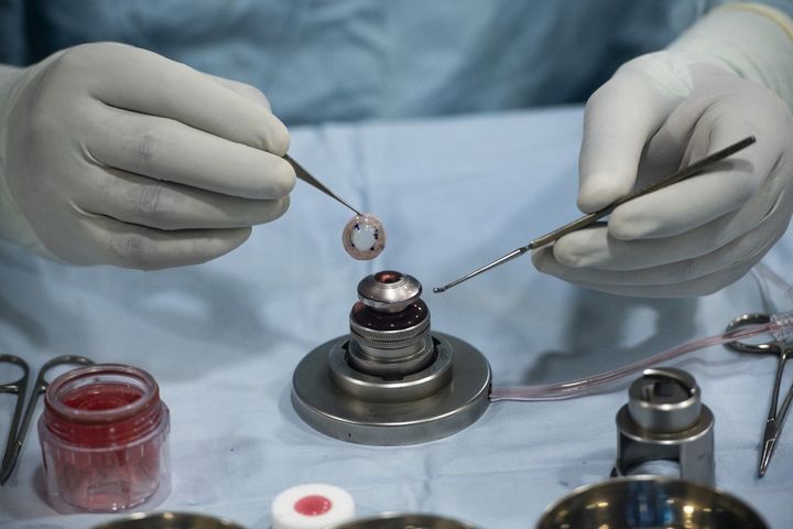 The Role Of Seed Funding For Alleviating Blindness In Poor Communities