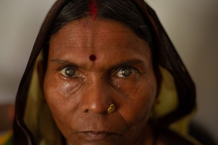 A Heart-breaking Insight Into The Reality of Poverty Blindness