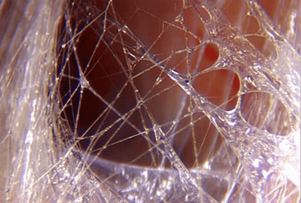 Death by over-simplification