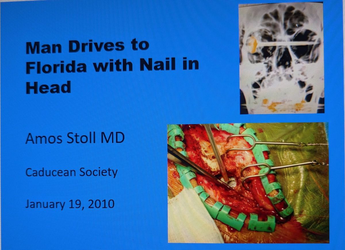Blog No 39   Man Attempts Suicide with Nail Gun