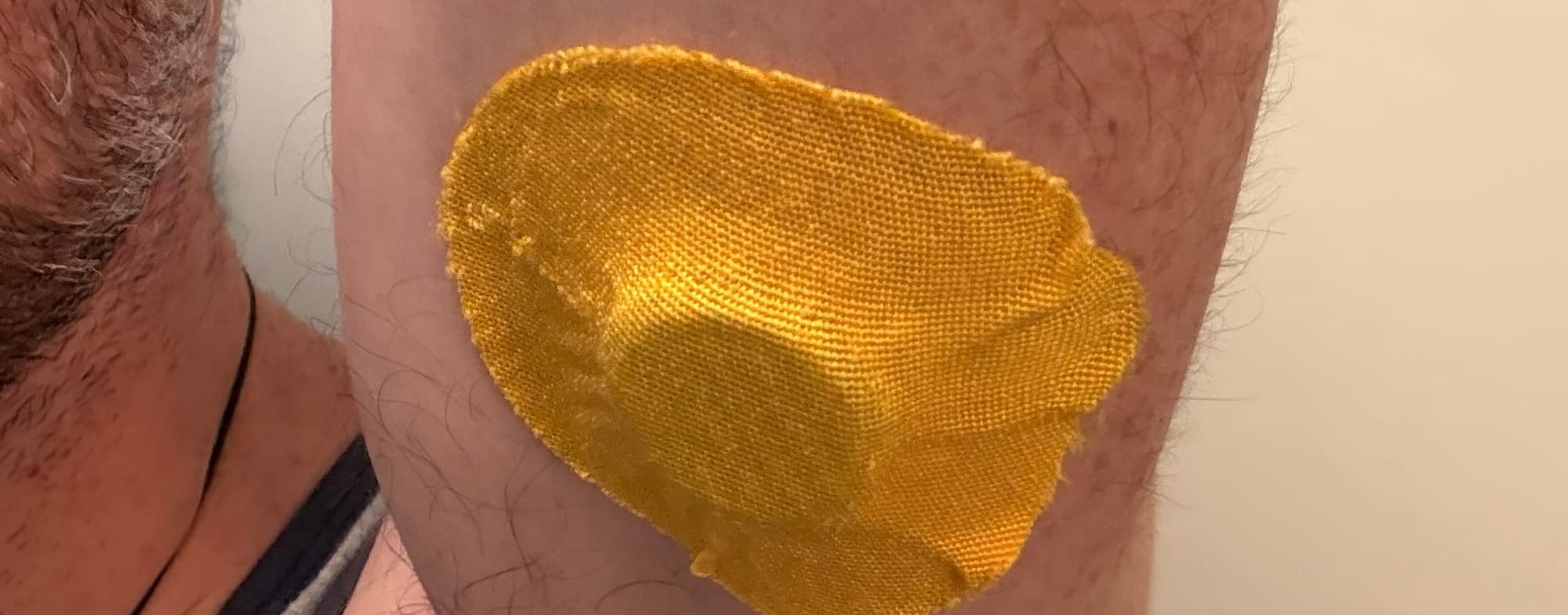 Close up of a glucose monitor on the underside of the arm covered by a waterproof cover