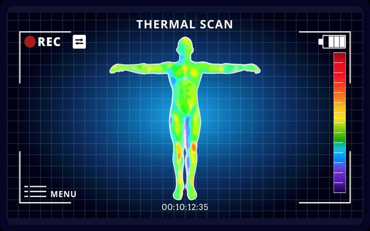 Thermographie infrarouge