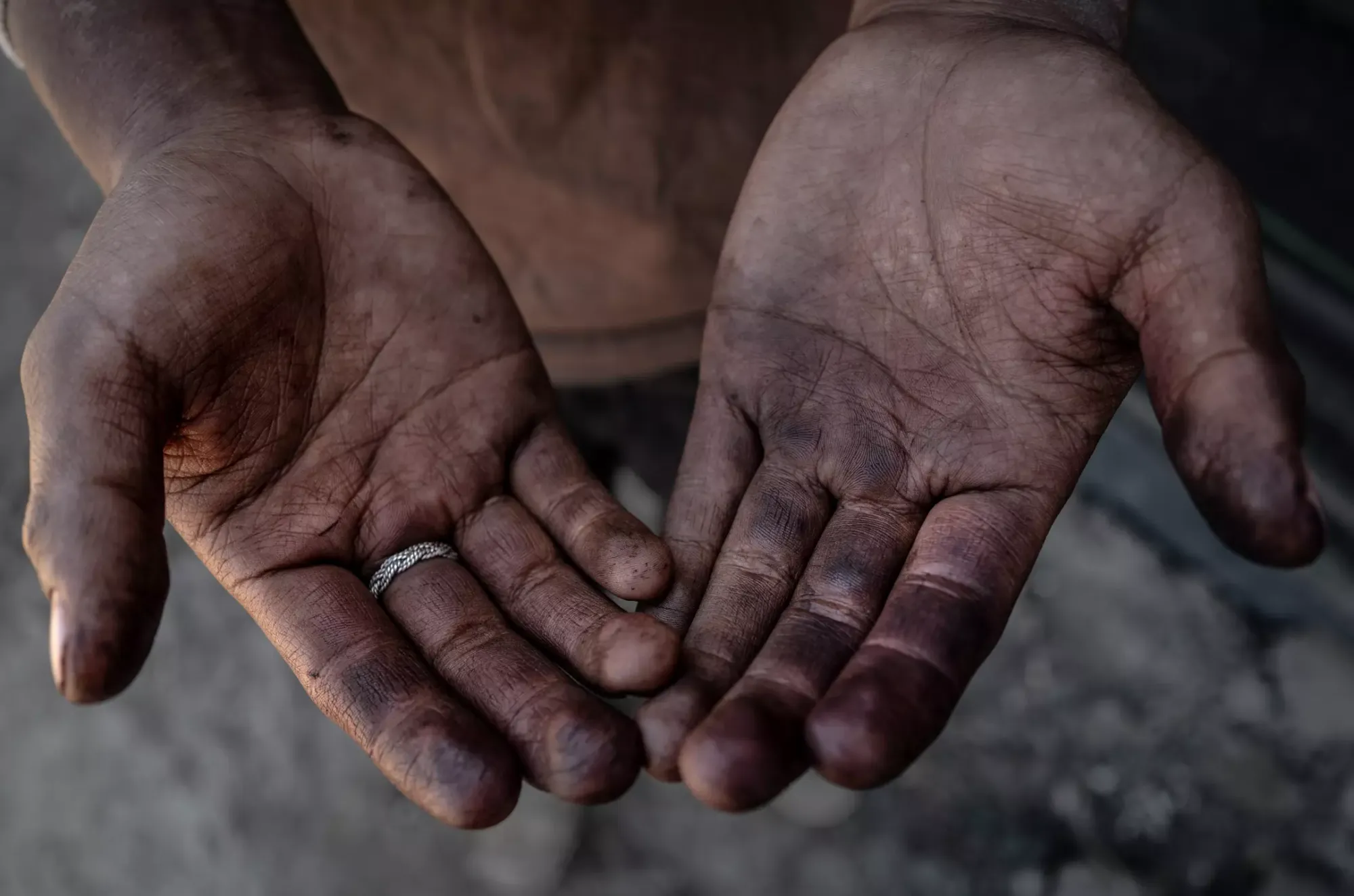 Hands covered in dirt with a ring on the ring finger