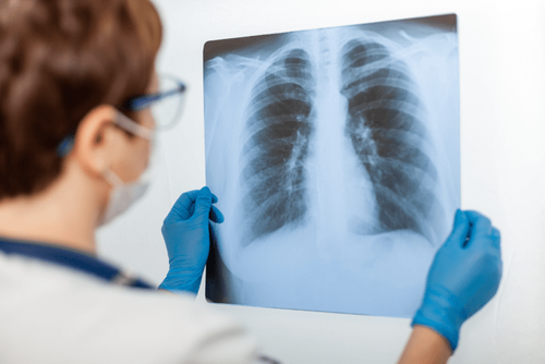 #TheWellnessCompay Via #ZeroHedge: What Is The White Lung Outbreak? Is It Real? Should You Be Worried?