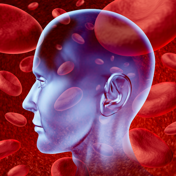 Saiba como prevenir e tratar o AVC