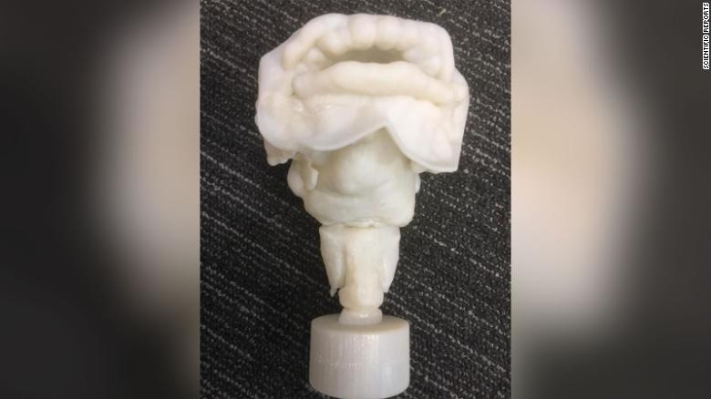 3-D printed vocal tract of Nesyamun