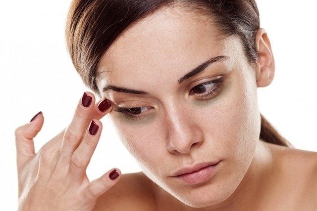 Luz Pulsada- quÃ© es, indicaciones e imÃ¡genes del antes y despuÃ©s