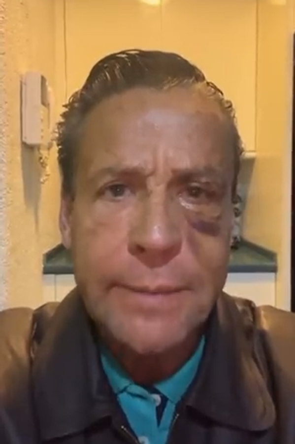 Alfredo Adame es hospitalizado