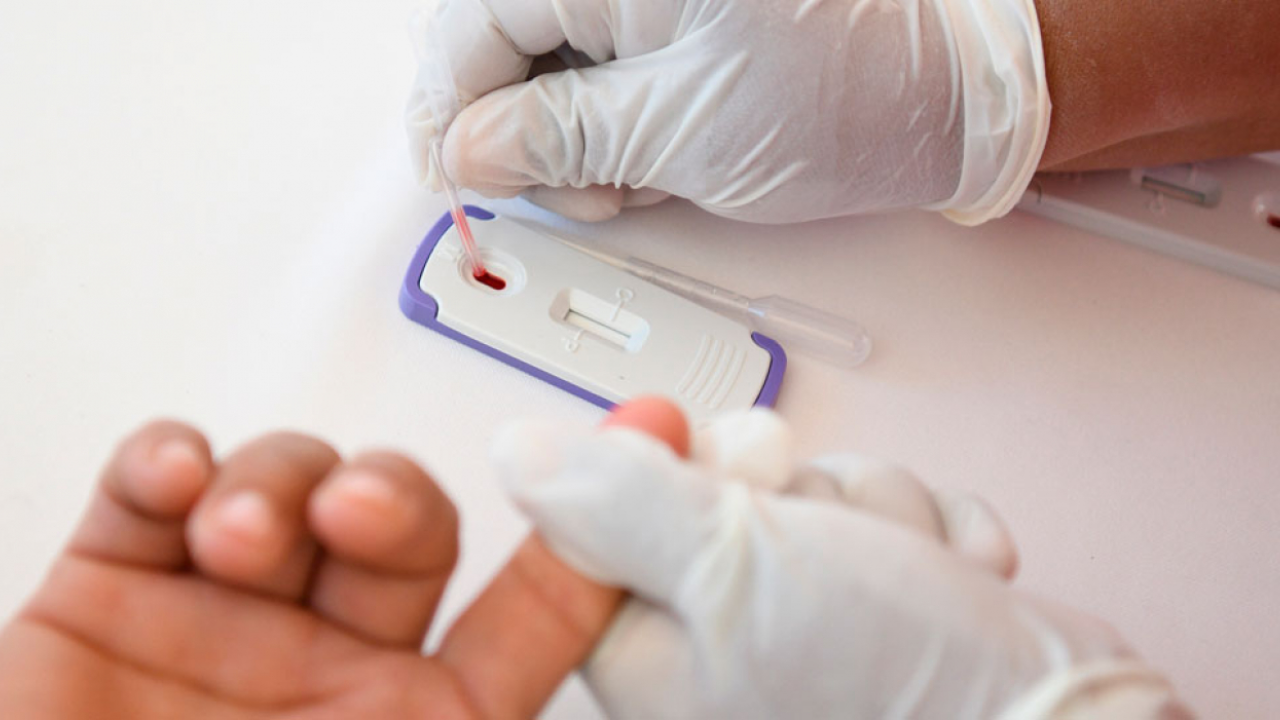 Aplicarán pruebas rápidas de VIH gratuitas, en el Zócalo de Cuernavaca