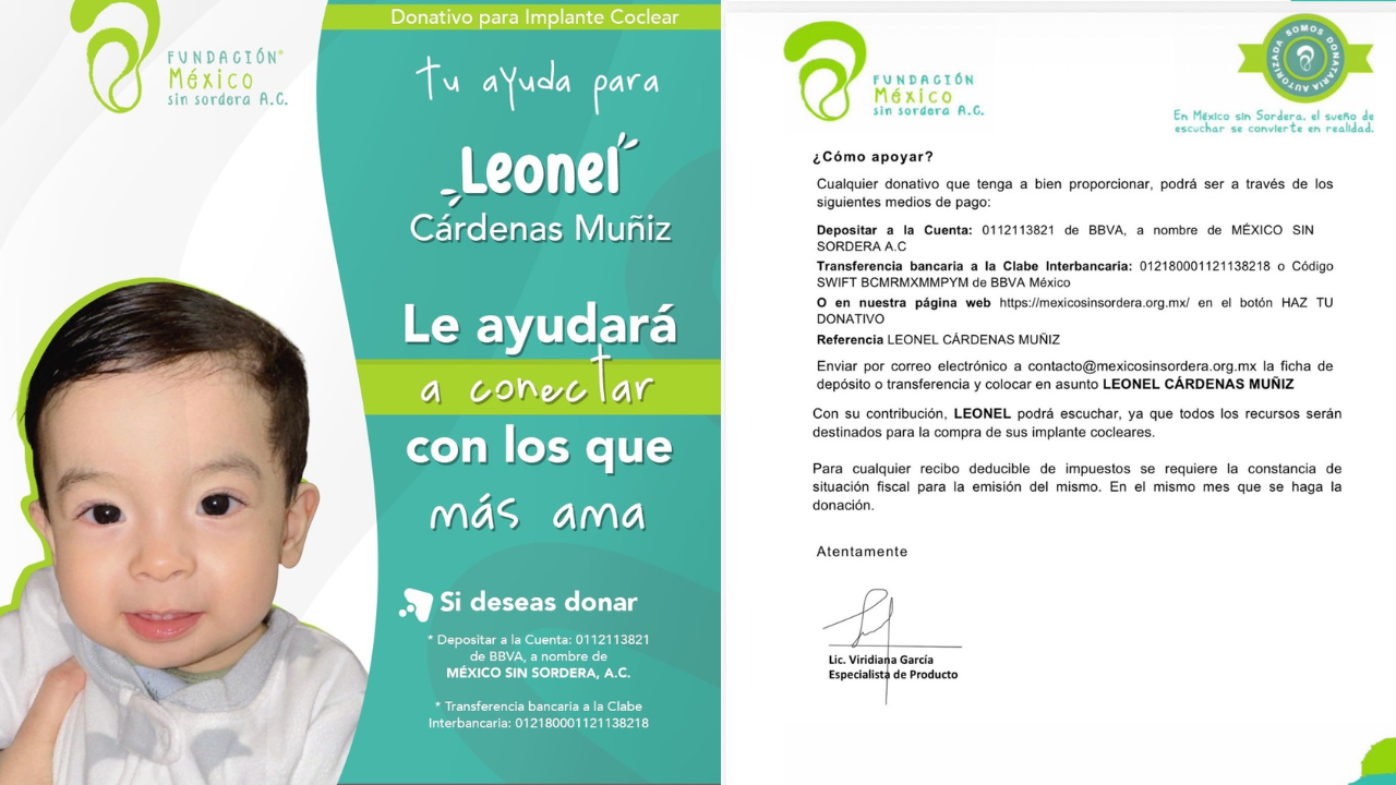 Fundación pide apoyo para que Leonel pueda escuchar gracias a un implante coclear